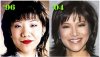 Julie_Surgery.jpg Julie_Surgery.jpg